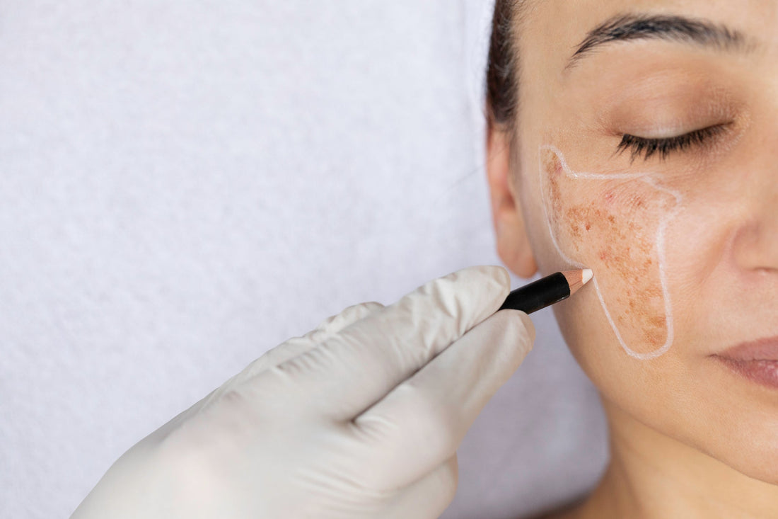 The First Signs of Menopause Your Skin Shows (Before You Realize What’s Happening)